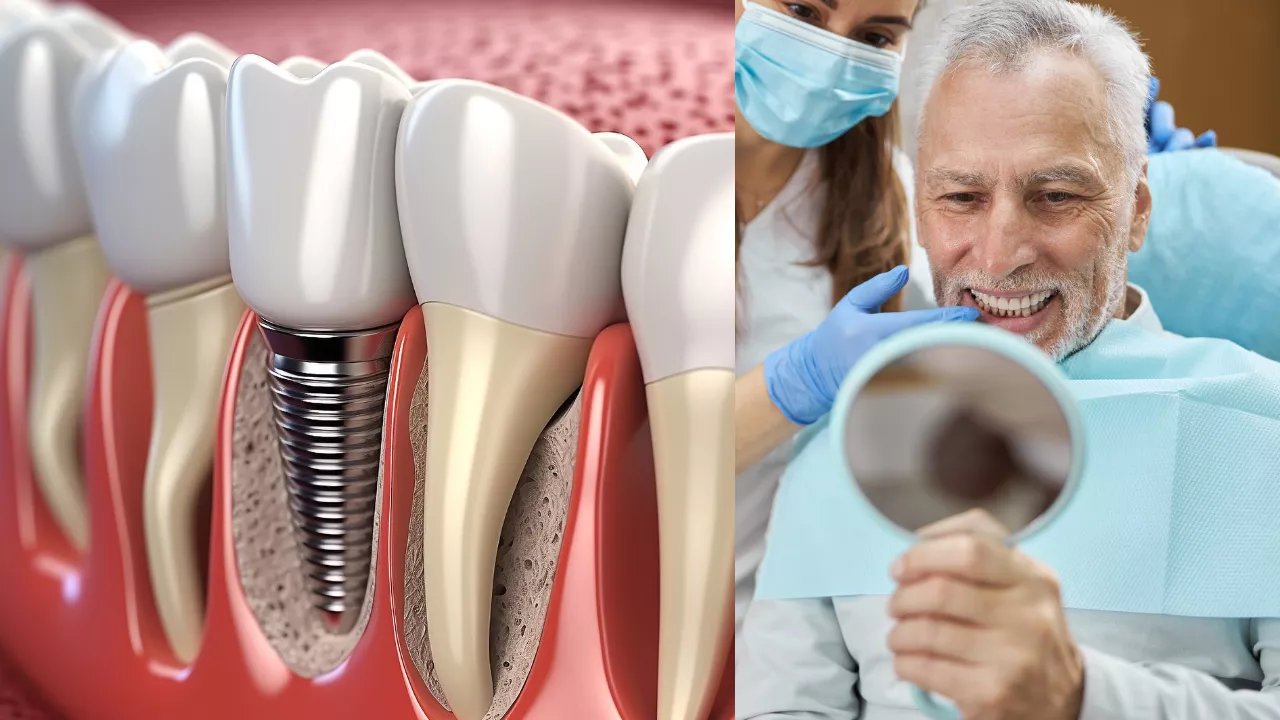 Are You Too Old for Dental Implants