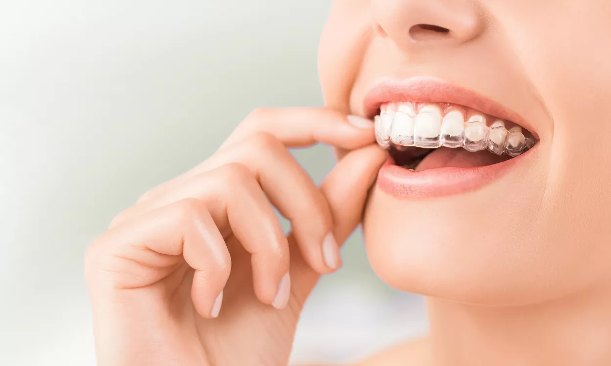 How Much Is Invisalign Without Insurance