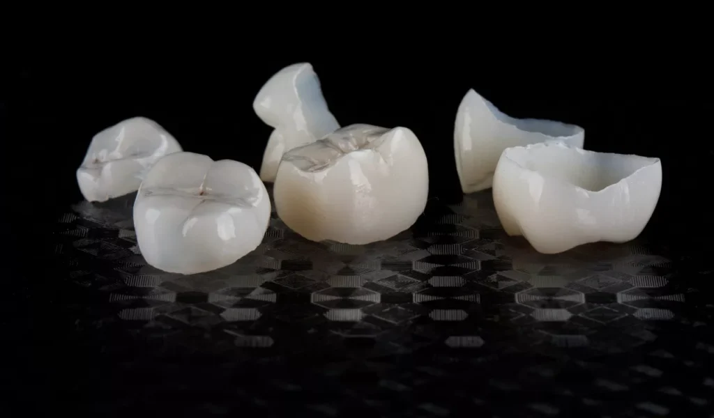 Dental Crown Falls Off