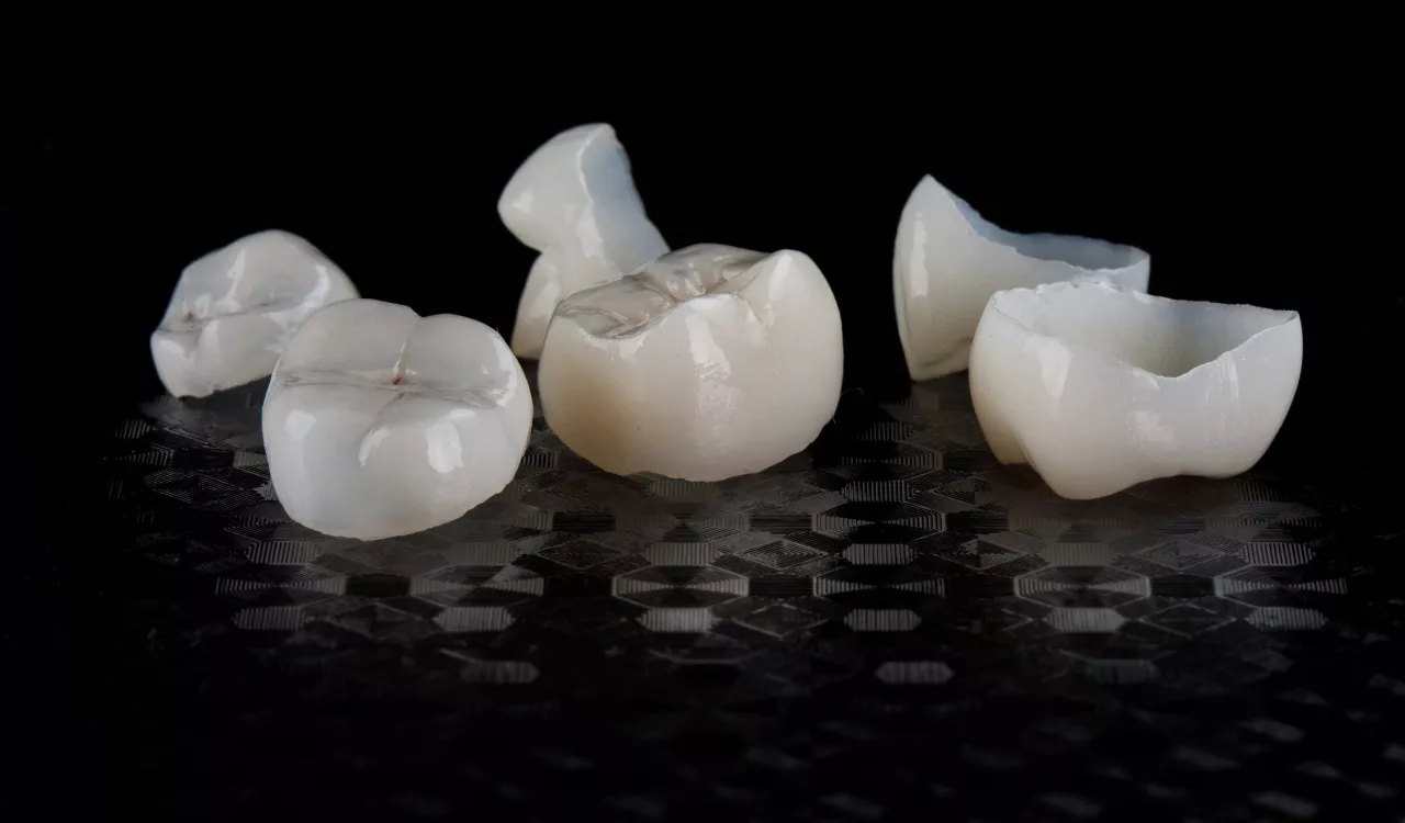 Dental Crown Falls Off